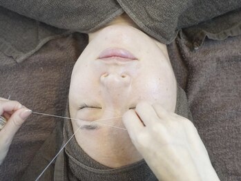 レブ(rev)/スレッティング（糸脱毛）