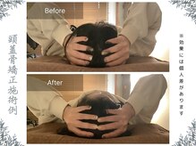 ボディ リセット アンド デザイン(Body Reset & Design)/【施術例】ビフォーアフター