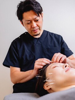 福 福岡院の写真/【美容効果だけではなくお体も元気に】お顔から体を整える鍼&頭蓋骨調整