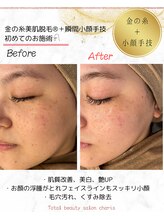 カリス(charis)/お顔の老廃物スッキリ☆