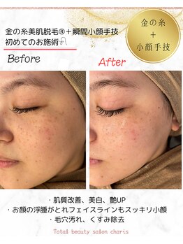 カリス(charis)/お顔の老廃物スッキリ☆