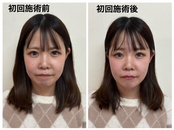 トータルバランス整体院 &nbsp;オレンジ(ORANGE)/小顔初回モニター/小顔矯正