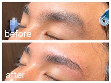 クラシックス(CLASSICS)/美眉wax脱毛