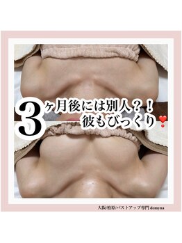 デミーナ(Demyna)/