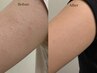 【ボディ一部位】ざらつき・ぶつぶつ改善 韓国式ハーブピーリング