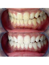 ライトビューティー 池袋店(LightBeauty)/症例写真