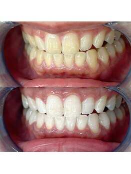 ライトビューティー 池袋店(LightBeauty)/症例写真