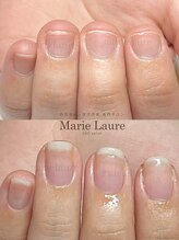 マリーロール 淀屋橋本店(Marie Laure)/深爪矯正/自爪育成/ネイルケア