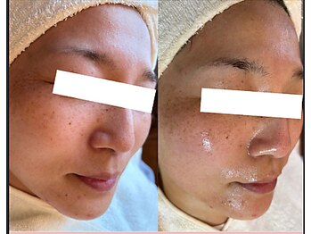 フルリール(Fleurir)/ツヤ肌フェイシャルワックス