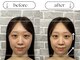 ビースタイル(B-style)の写真