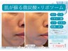 【シワ/くすみ/ニキビ/しみ】微炭酸×リポソーム肌力復活フェイシャル7,700円