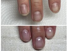 二枚爪での地爪育成