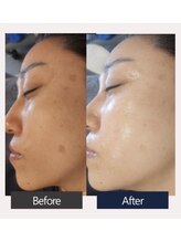 エスビーエス オキナワ(SBS OKINAWA)/第5世代ダクトピールモニター様