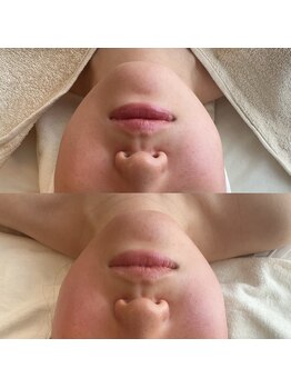 サロン ド ビビ(salon de bibi*)/一度の施術効果の大きさ！