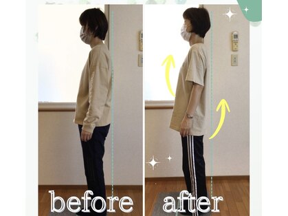 キノン(kinon)の写真