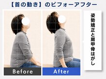 堺 中百舌鳥駅前整体院/眼精疲労の方に♪