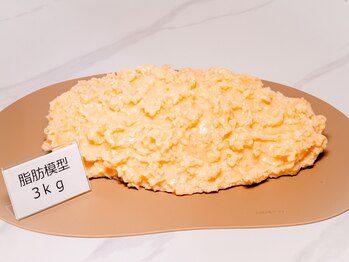 楽々 蓮田店(lala)/≪脂肪模型≫