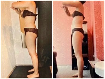 パーフェクトボディプレミアム 札幌大通店(PERFECT BODY PREMIUM)/お客様　ビフォーアフター（25）