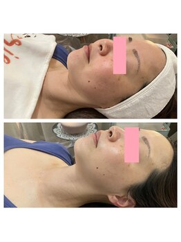 エリー(ERIE)/クリスティーナ アンストレス