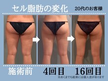 ボディエステティック アクアオーラ 高岡店/