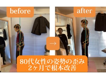 東京G整体/姿勢矯正