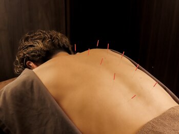 エイチスリー 表参道院/根強いコリに鍼灸コース!