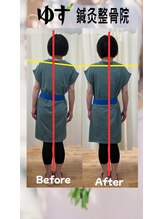 ゆず鍼灸整骨院/たった一度でこの変化！