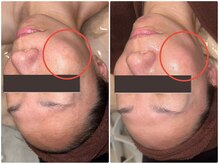 エルマナ(Hermana)/