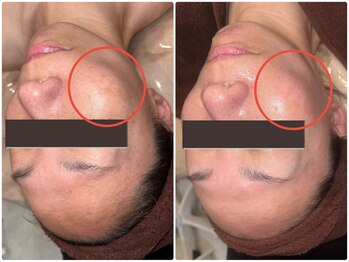 エルマナ(Hermana)/