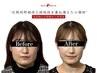 【圧倒的即効性と持続性を兼ね備えた小顔術】美容鍼or小顔矯正×高周波 