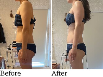 アヤ(Aya)/痩身90分×5回ビフォーアフター