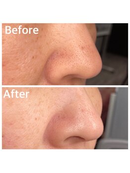 肌管理-SIASKIN-【4/1 NEW OPEN(予定)】/毛穴お悩みのお客様