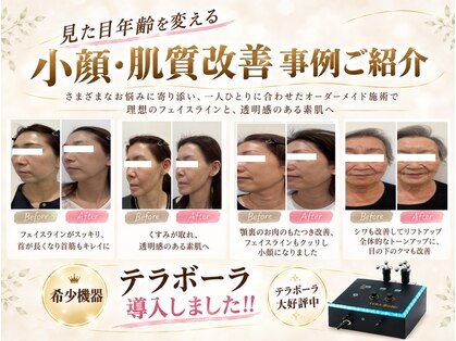 ルアナ ナオ(Luana Nao)の写真