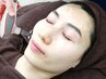 【極上巡り小顔】ラジオ波フェイシャル+表情筋美容鍼60分◎施術60分・全90分