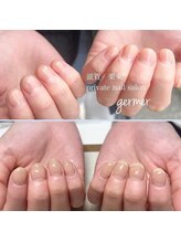 ジェルメ(germer)/１回目の施術後と二回目の変化！