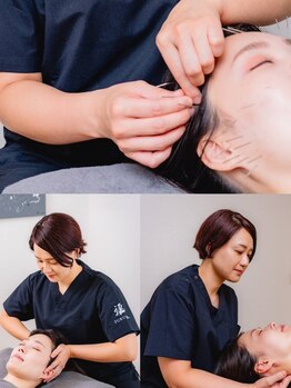 福 福岡院の写真/【ブライダル・撮影前に◎】3回の施術で最高のコンディションを！！通常￥29,700→￥19,900