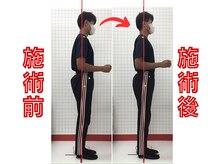 ほねつぎ須屋鍼灸接骨院/反り腰・猫背矯正