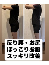 美ボディ整体院/反り腰・ぽっこりお腹も同時改善