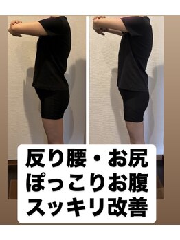 美ボディ整体院/反り腰・ぽっこりお腹も同時改善