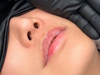 ラヌイ(LANUI)の写真/【トレンドのローマピンク専門店がNEW OPEN♪】くすみや黒ずみを改善し、若々しい印象へと導きます☆