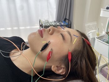 ハリトト鍼灸院の写真/肌ケア美容鍼で若々しい見た目へ♪フェイスラインがスッキリ！むくみ・エラ張り・食いしばり・肌質改善に◎
