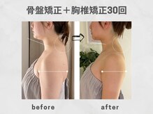ビトリア 小顔 骨盤美容矯正サロン(BITORIA)/骨盤胸椎矯正＋超音波ケア