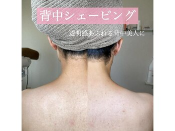 リンド エステ まつげ 京成大久保(Lind)/背中シェービング