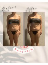 リンガ(Ringa)/ビフォーアフター【内臓活性】