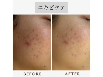 チューズ 北参道 代々木店(CHOOSE)