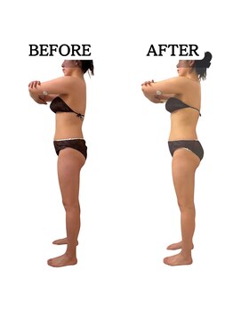 エミニー(EMINY)/