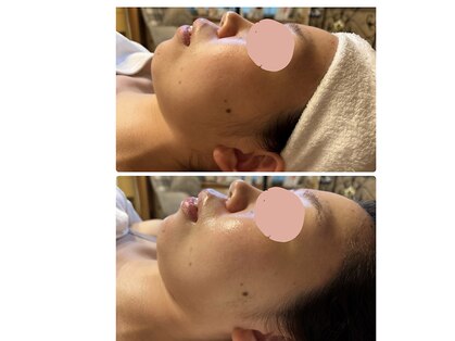 サロン リノ(salon rino)の写真