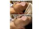 サロン リノ(salon rino)の写真