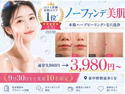 メルヴェイユの写真