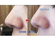 美と健康と痩身サロン マリアローズ(Maria Rose)/ハイドラフェイシャル